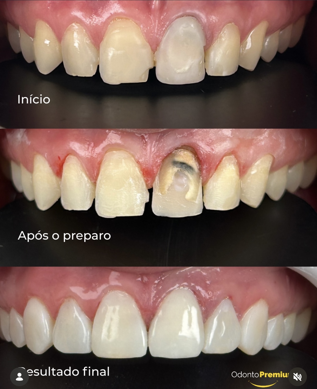 Caso clínico 3 — antes e depois