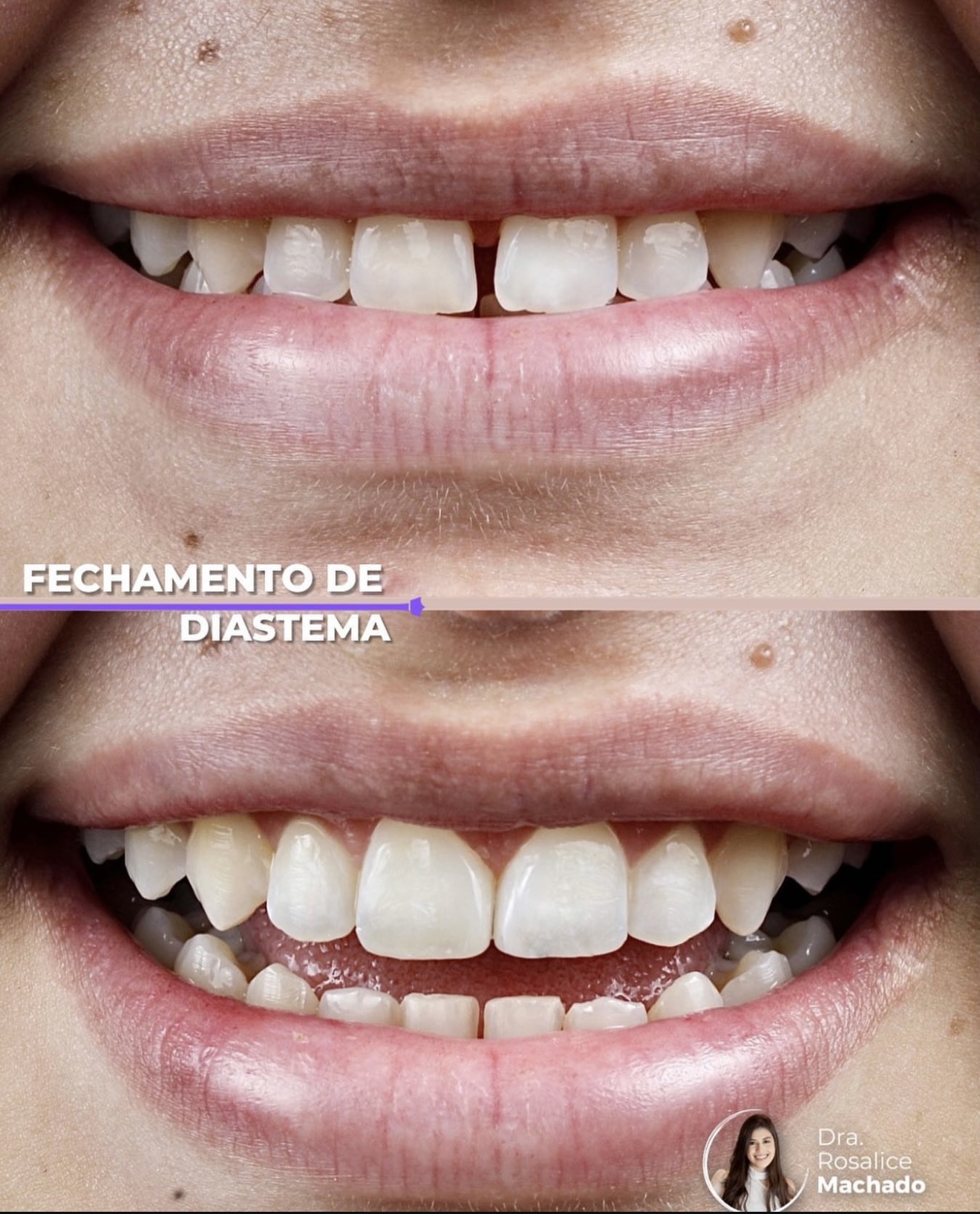Caso clínico 8 — antes e depois